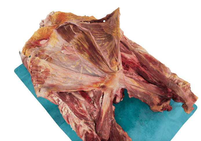 Photorealistic 3D hip scan of a human body donor from Augmedi