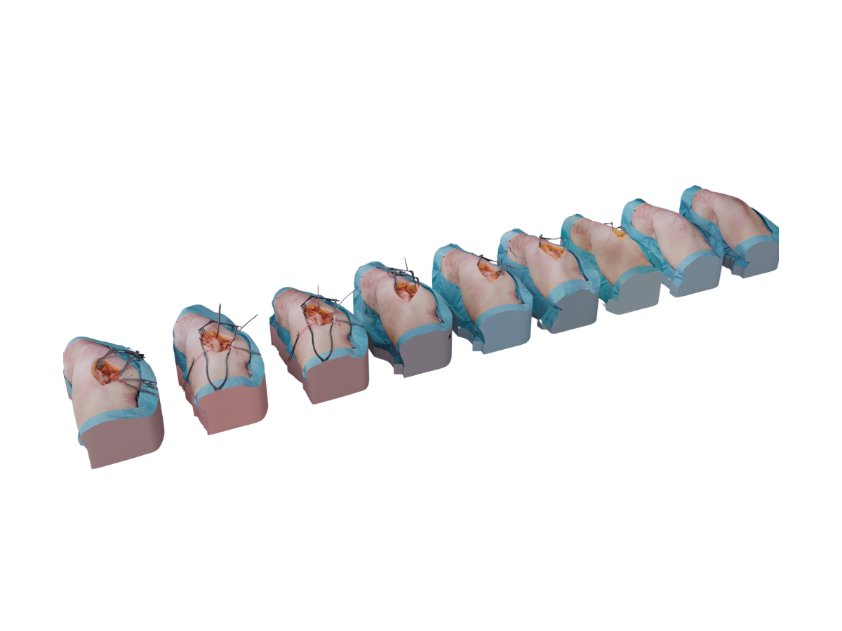 Hip-Approach-in-a-row